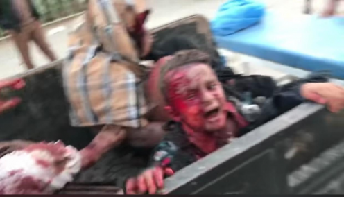 حالة وفاة و٢٠ جريحا حصيلة  حادث انفجار فرن صمون في