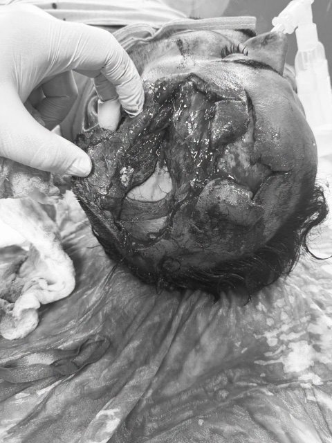 صورة مرفقة