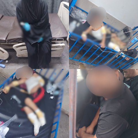 بعد اعتدائه على زوجته وأطفاله بالماء الساخن.. شرطة الرصافة تلقي القبض على المتهم داخل المستشفى